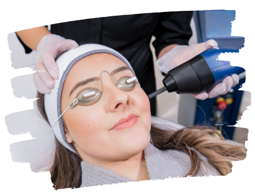 Benefits of Ablative Erbium YAG Laser