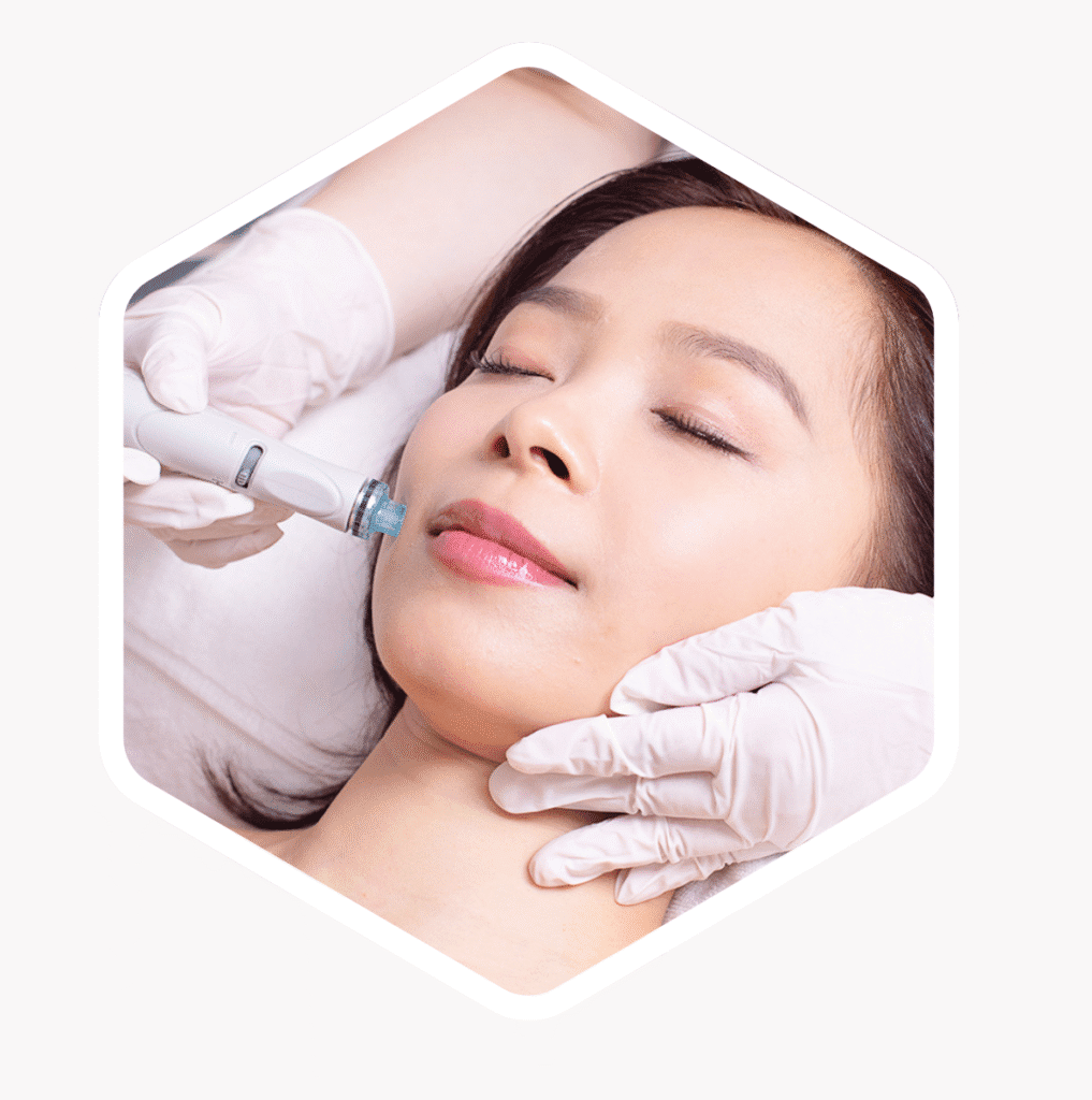 DFA London Hydrafacial