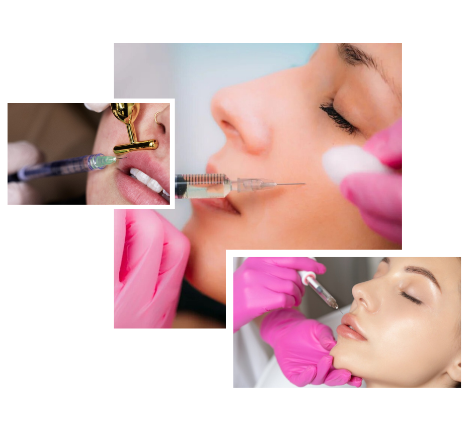 Dermal Fillers in London