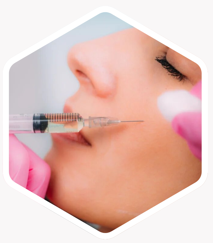 How Often Should You Get Cheek Fillers