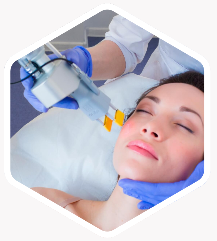 How Often Should You Get Q-Switch NdYAG Laser Treatments​