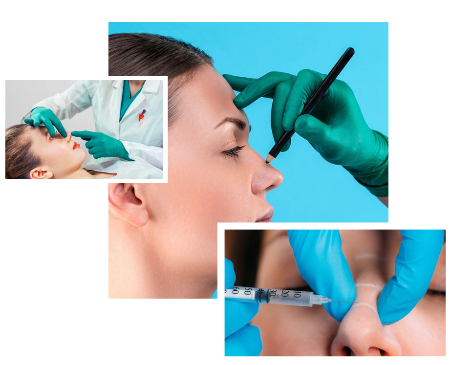 Liquid rhinoplasty london