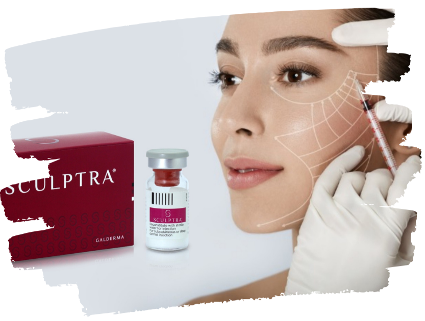 Benefits of Sculptra Fillers