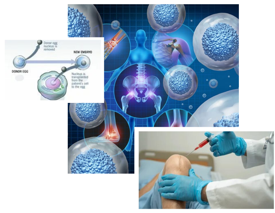 Extracellular Matrix Stem Cell Recruiter Therapy in London