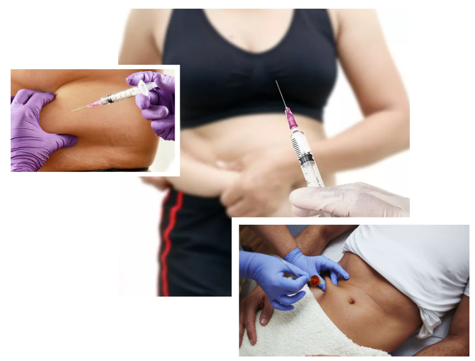 Fat-Busting Injections in London