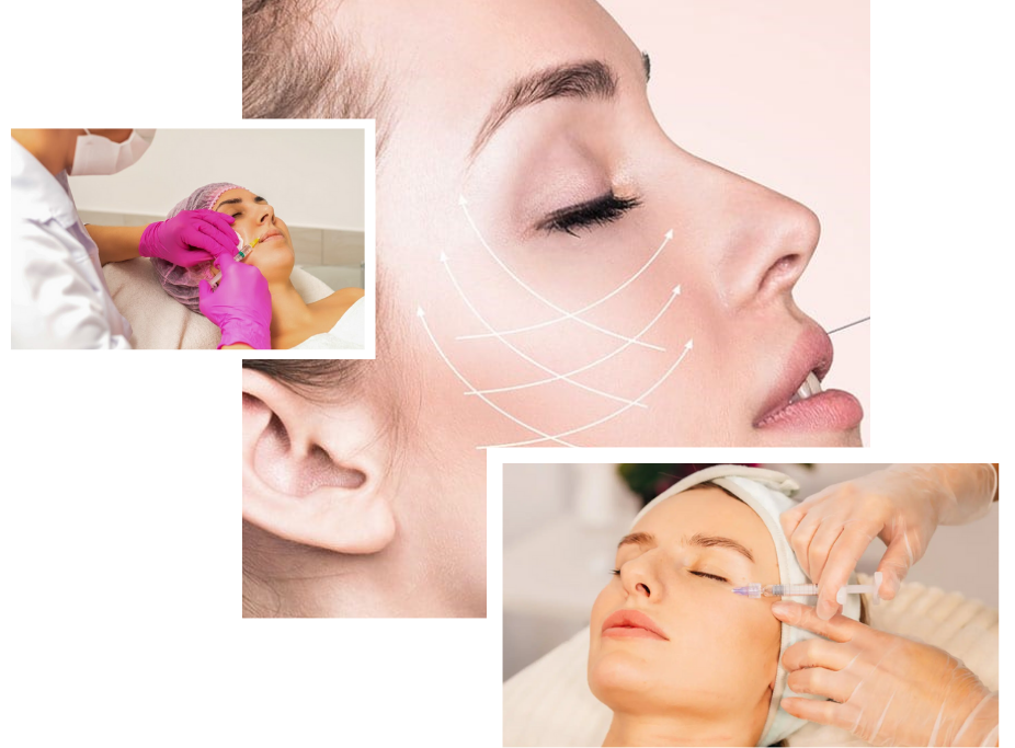 Nano Fat Grafting in London