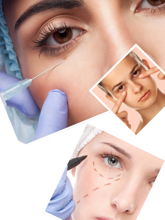 Our Signature Dark Circle Correction Process