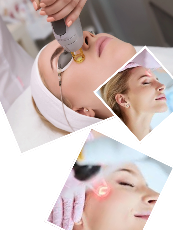 Our Signature Erbium YAG Laser Process