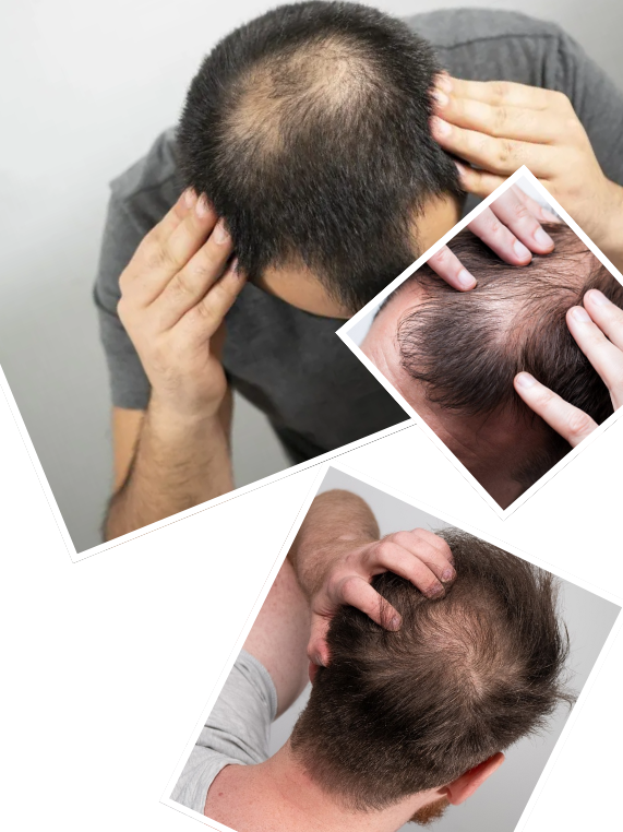 Our Signature Hair Restoration Process