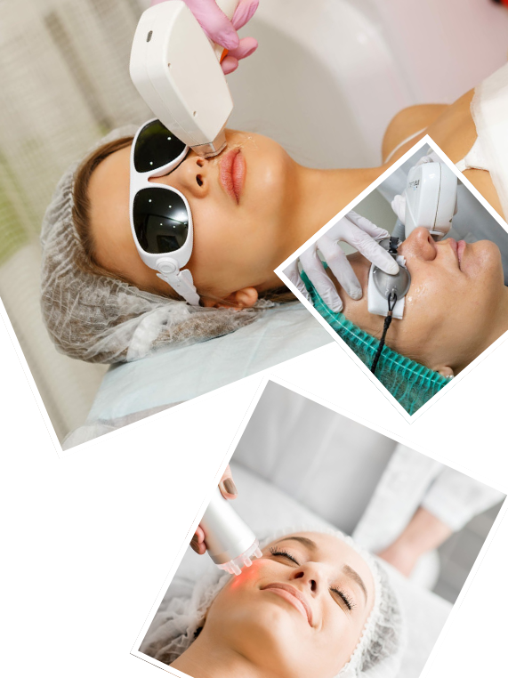 Our Signature IPL Process