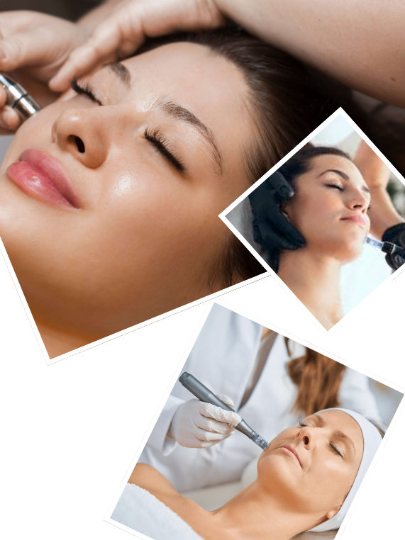 Our Signature Microneedling Process