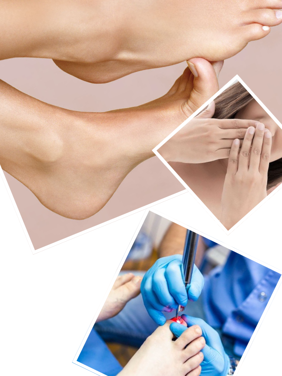 Our Signature Nail Fungus Treatment Process