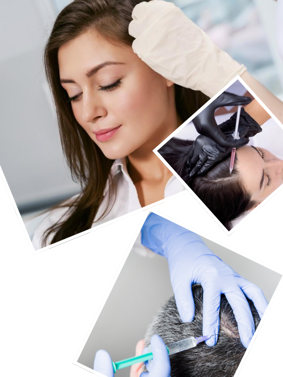 Our Signature PRP Hair Treatment Process