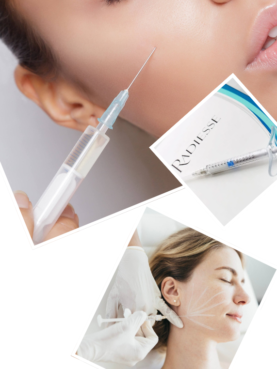 Our Signature Radiesse Injection Process
