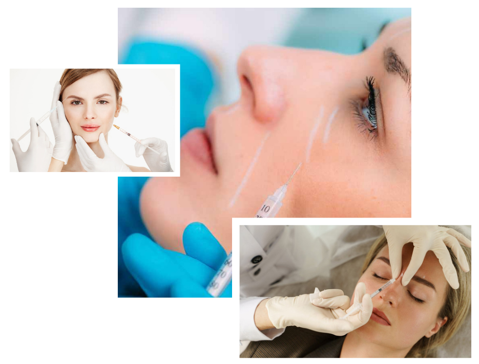 Sculptra Fillers in London