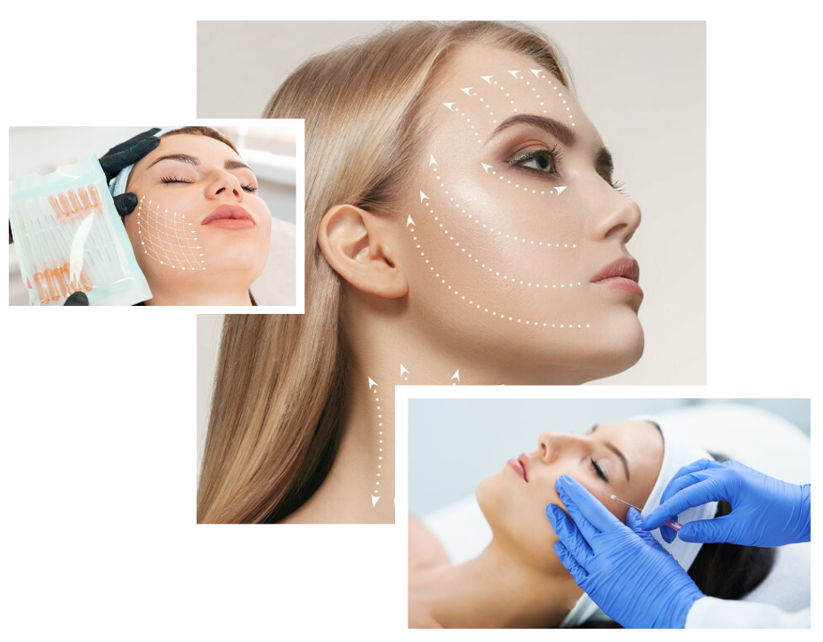 Thread Lift in London