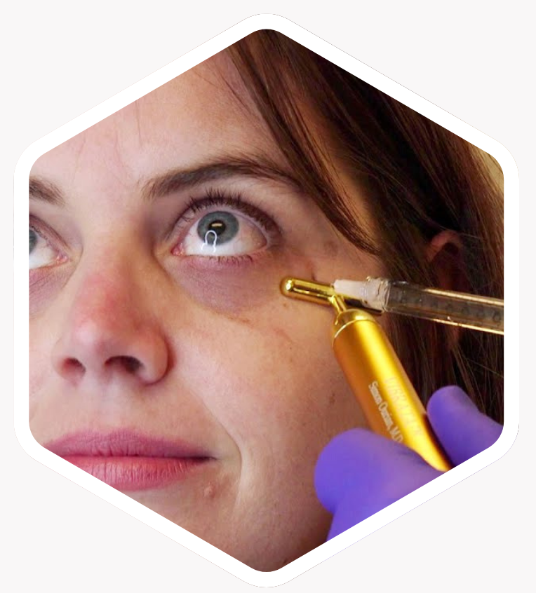 Who is Dark Circle Treatment Suitable For