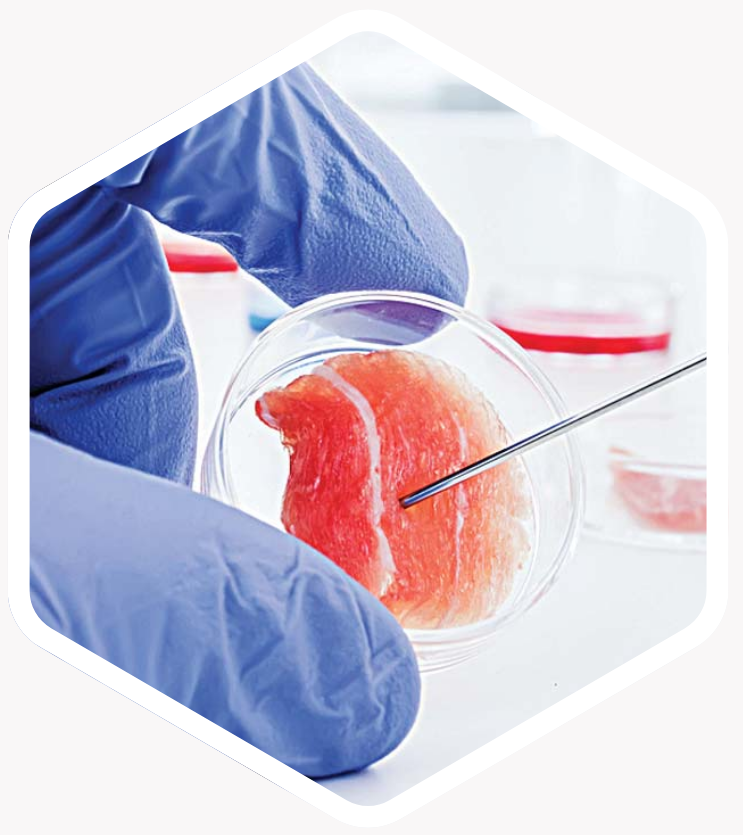 Why Choose Our London Clinic for Extracellular Matrix Stem Cell Recruiter Therapy