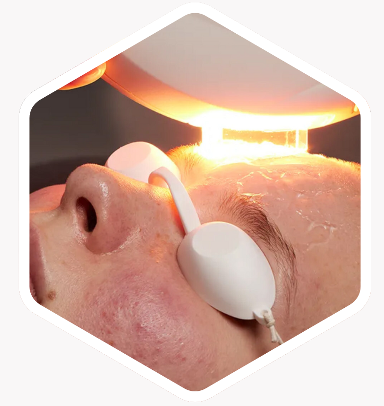 Who is IPL Treatment Suitable For