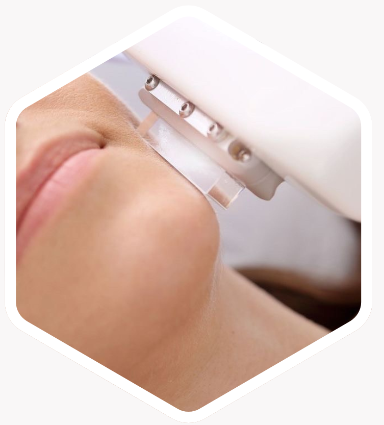 Who is Pico Laser Treatment Suitable For