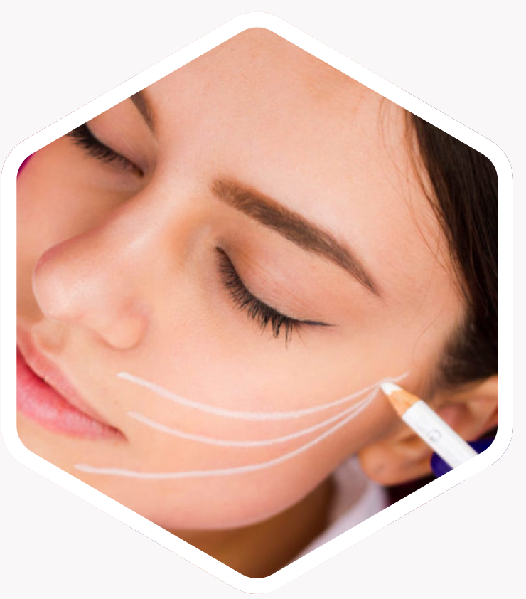 Who is Thread Lift Suitable For