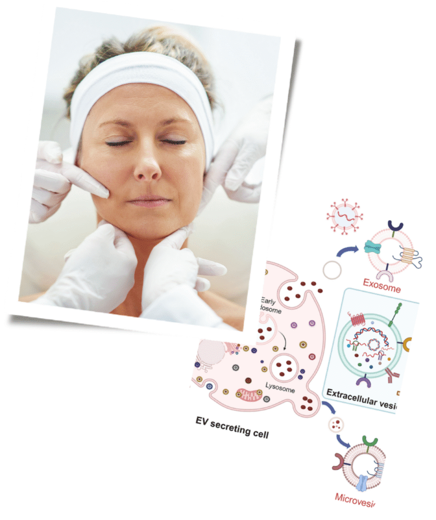 Why Choose Our London Clinic for Exosome Therapy