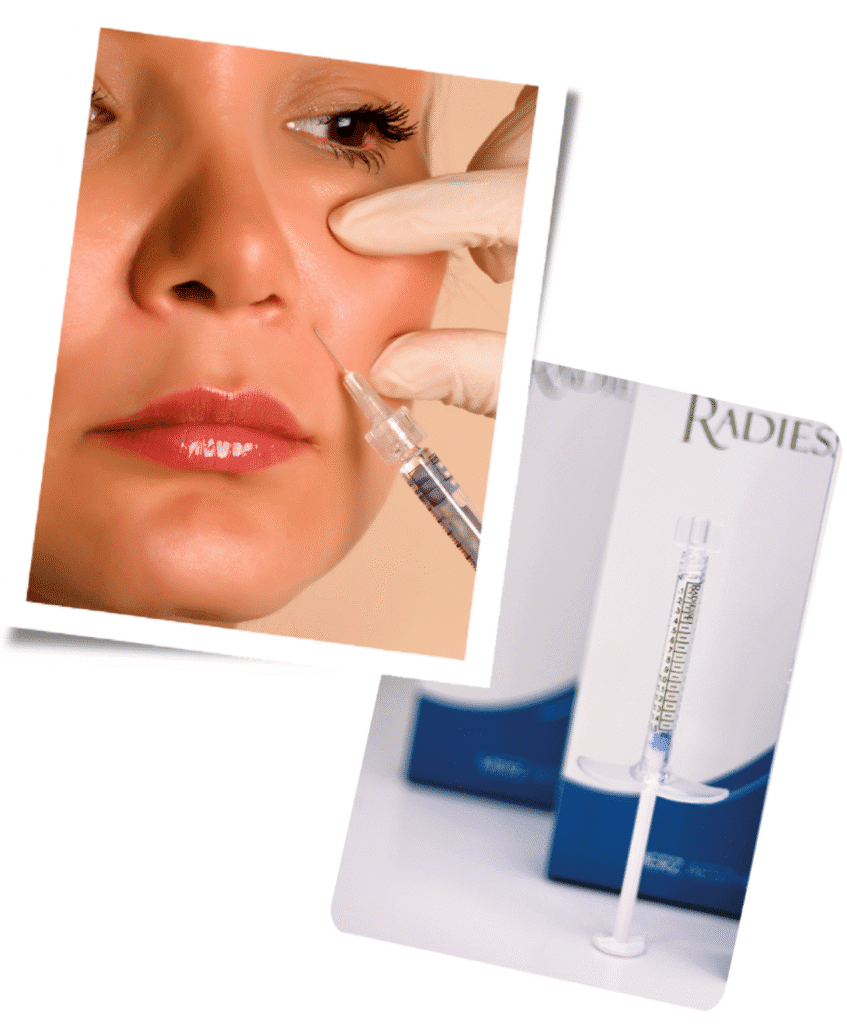 Why Choose Our London Clinic for Radiesse Fillers